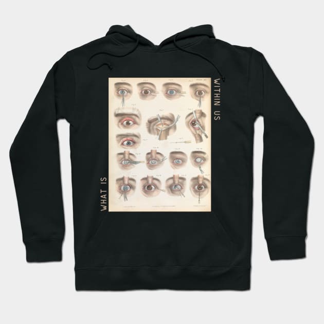 What is Within Us Vintage Tee Collection// Eye Surgery Hoodie by ArtHaven